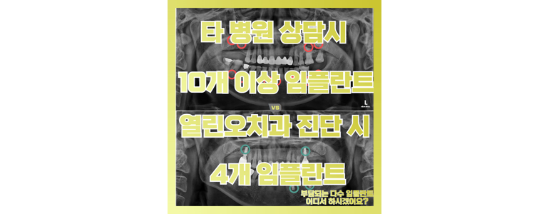 평택시 틀니 병원