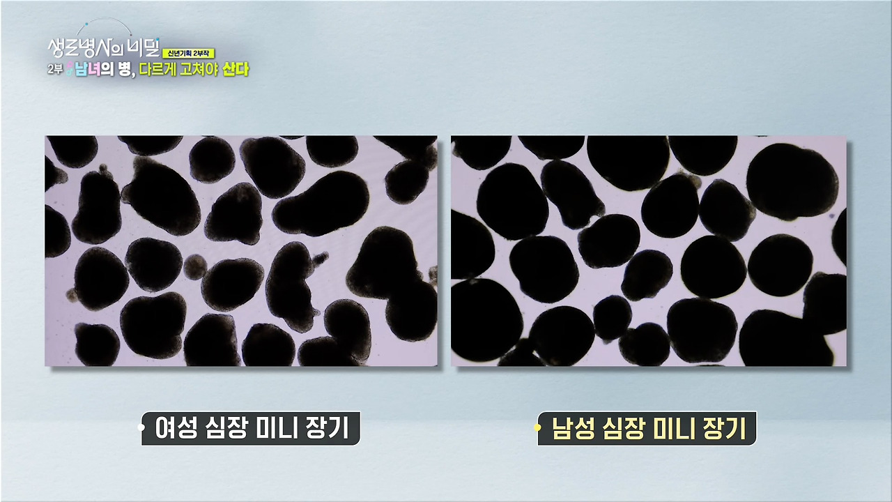 생로병사의 비밀 성차의학 미래 맞춤치료