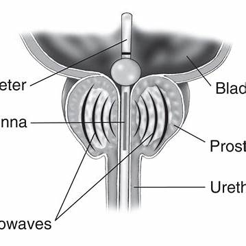 50대 남성 전립선 건강 이상 신호는 뭐가 있을까