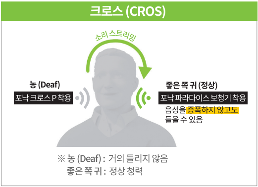 크로스 보청기
