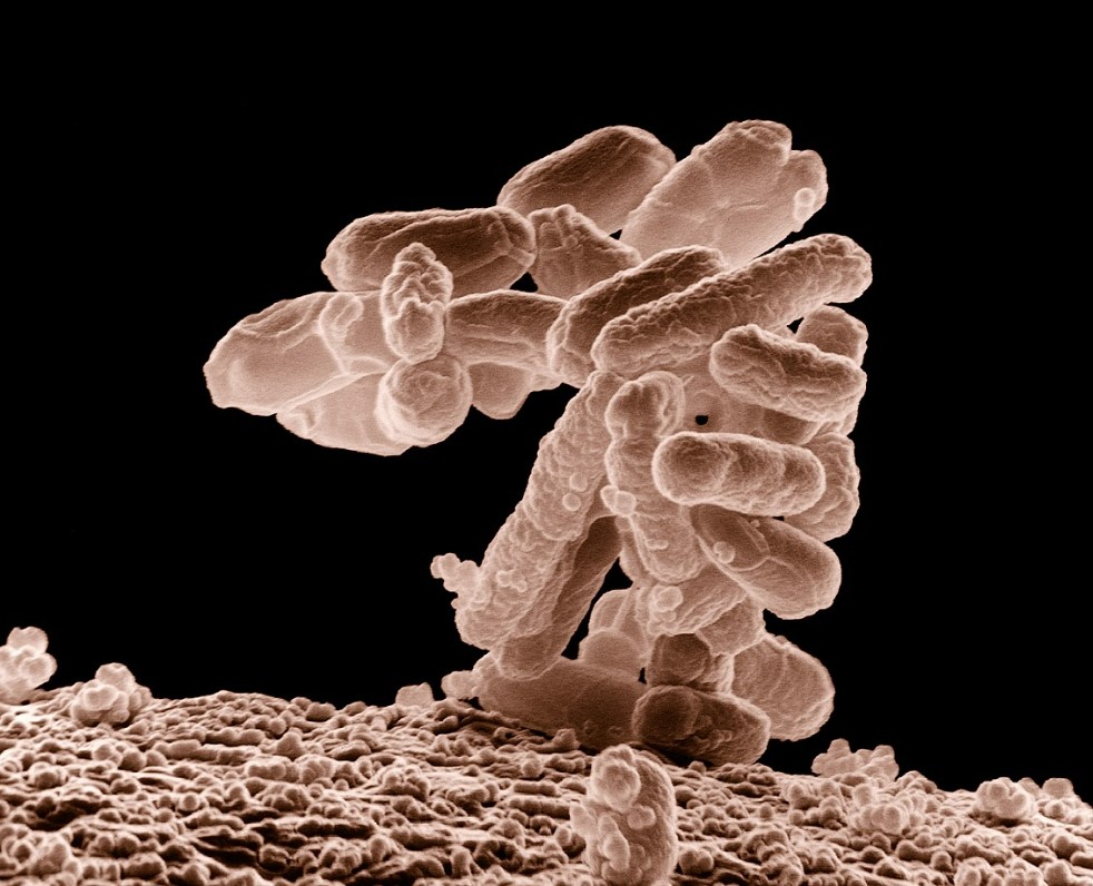 장내 미생물군이 전신 질환에 미치는 영향과 메커니즘