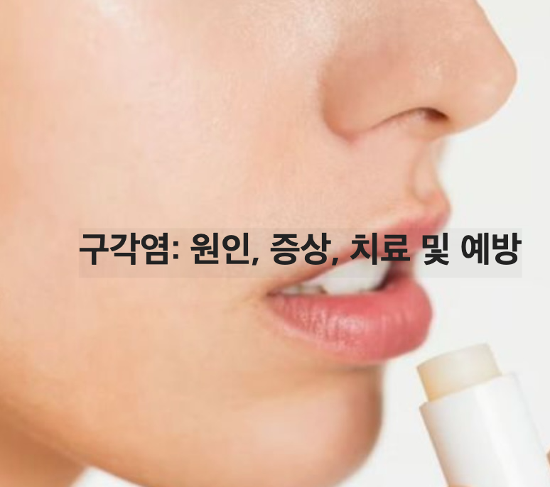 구각염: 원인, 증상, 치료 및 예방