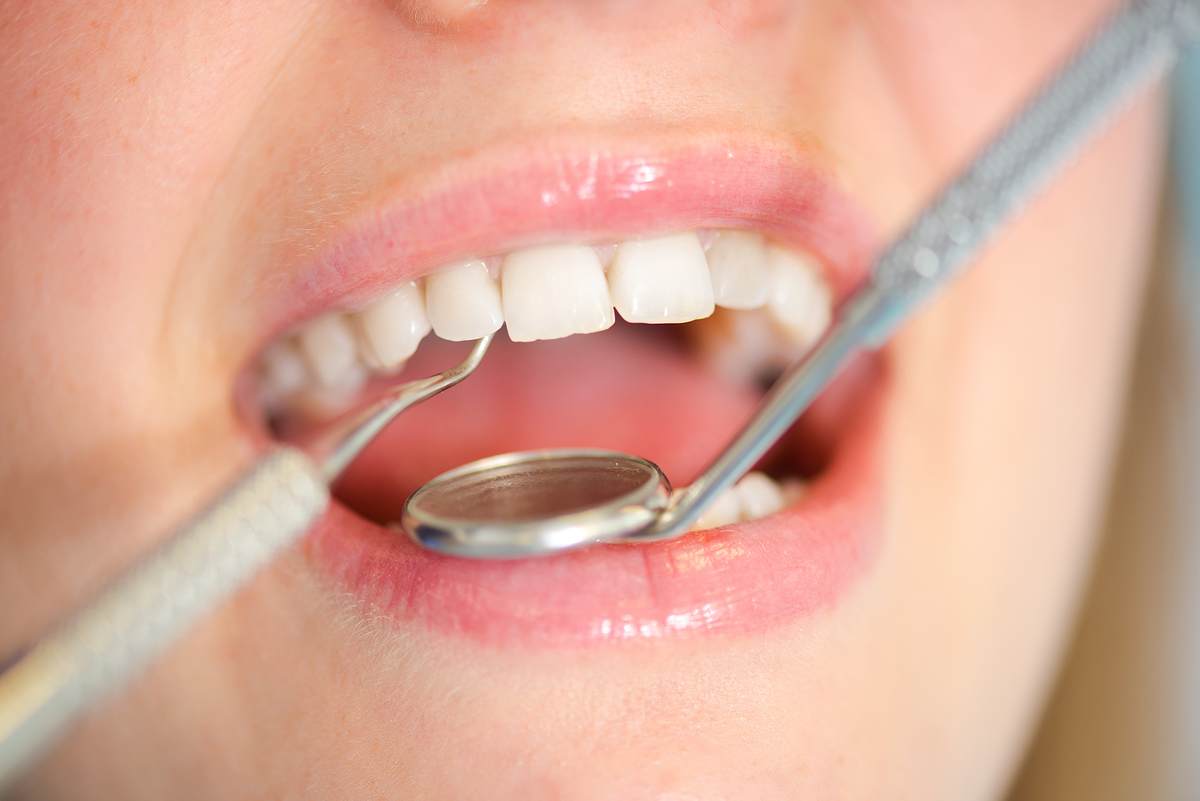 잇몸이 붓고 아플때