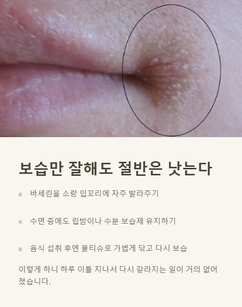 보습만 잘해도 절반은 낫는다