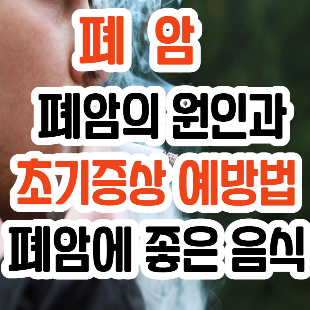 폐암 / 폐암의 원인과 초기증상 예방법/ 폐암에 좋은 음식