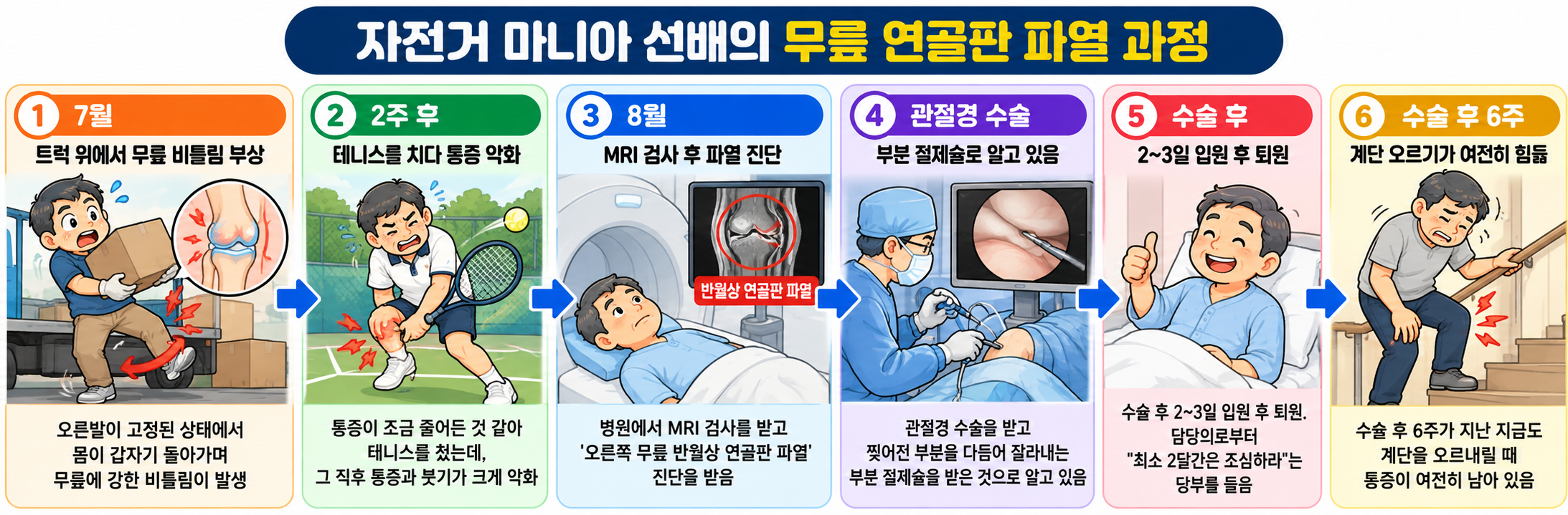 무릎 비틀림 부상부터 테니스 후 악화, MRI 진단, 관절경 수술, 수술 6주 뒤 계단 통증까지의 반월상 연골판 파열 타임라인