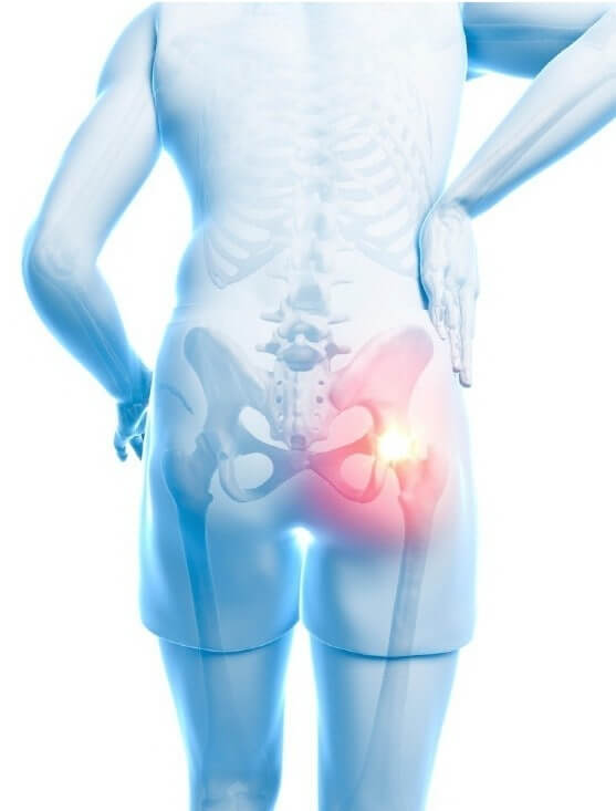 고관절 통증 7일 완화 루틴