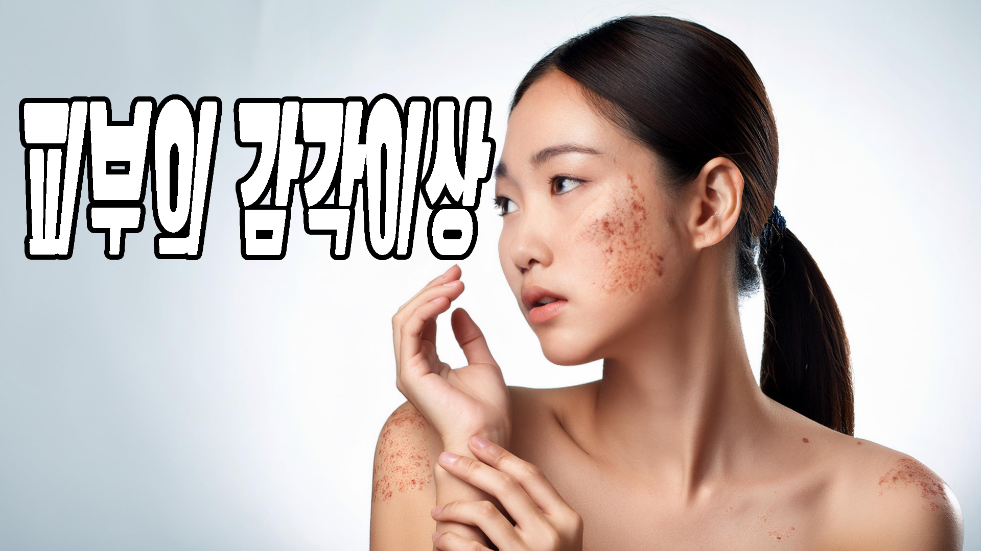 피부의 감각이상