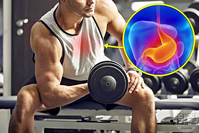 운동 가슴통증 원인 운동후 가슴통증 흉통 속쓰림 위식도역류