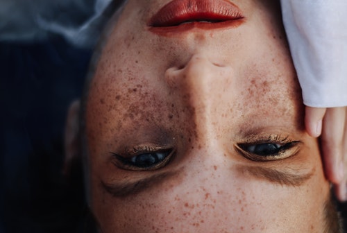 여드름 흉터 면역 기능 방지