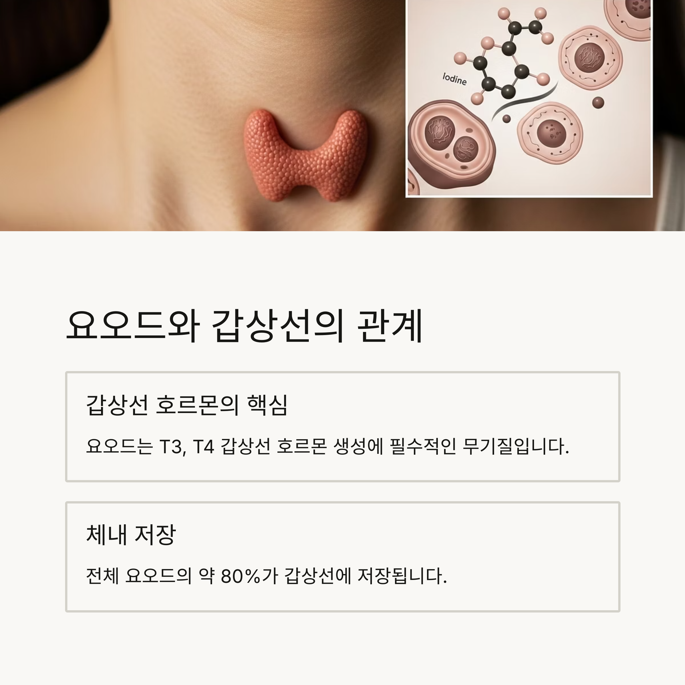 요오드와 갑상선의 관계