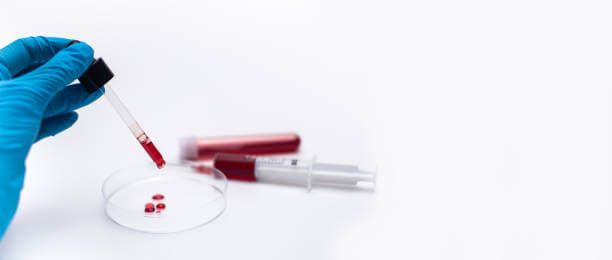 배란혈 원인과 색과 기간은? 배란혈이 나오는 이유와 정상적인 색은 어떤 색일까요? 또한 배란혈 기간은 어떤식으로 계산을 해야 하는지 꼼꼼히 읽어 보시기 바랍니다!