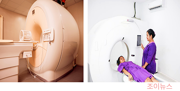 간암 진단 방법 - CT검사