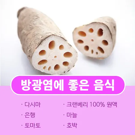 방광염에 좋은 음식