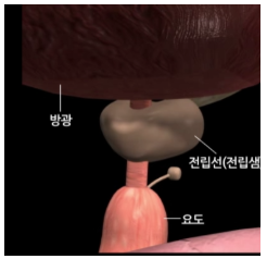 전립선사진