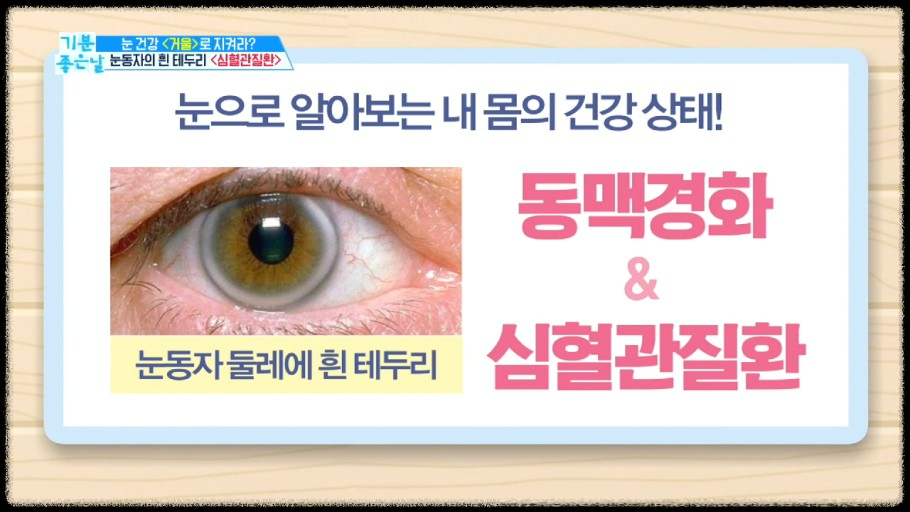 눈 건강&amp;#44; 조기 진단의 열쇠