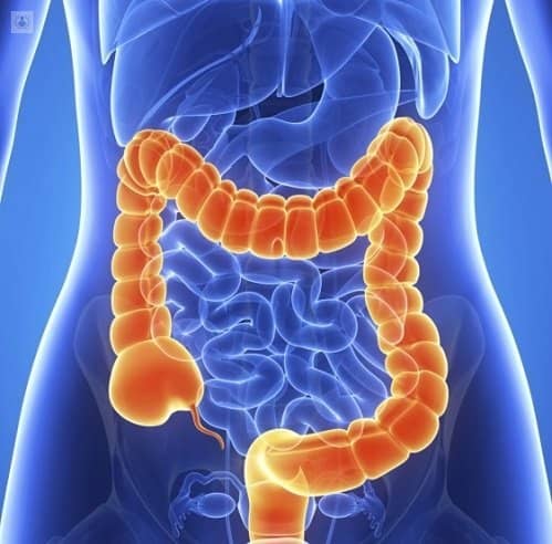 장(intestine)