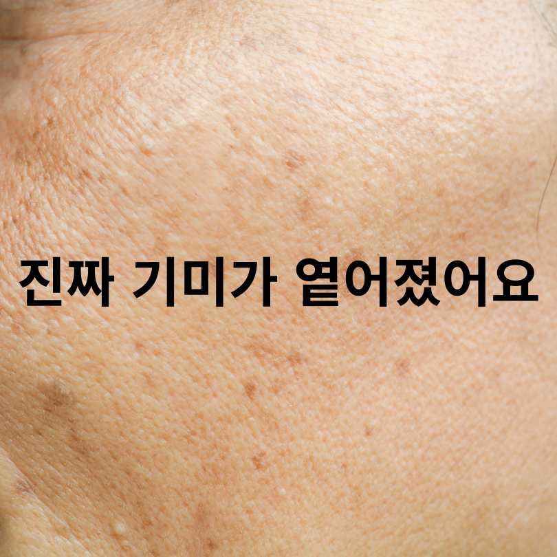 매스틱기미효능