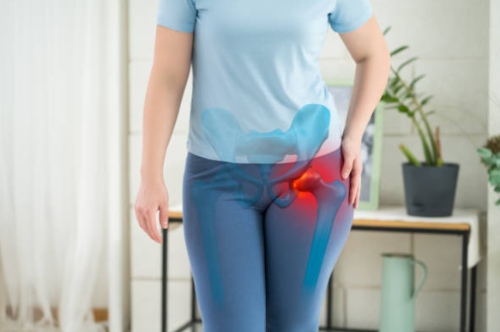 고관절 통증의 주요 원인