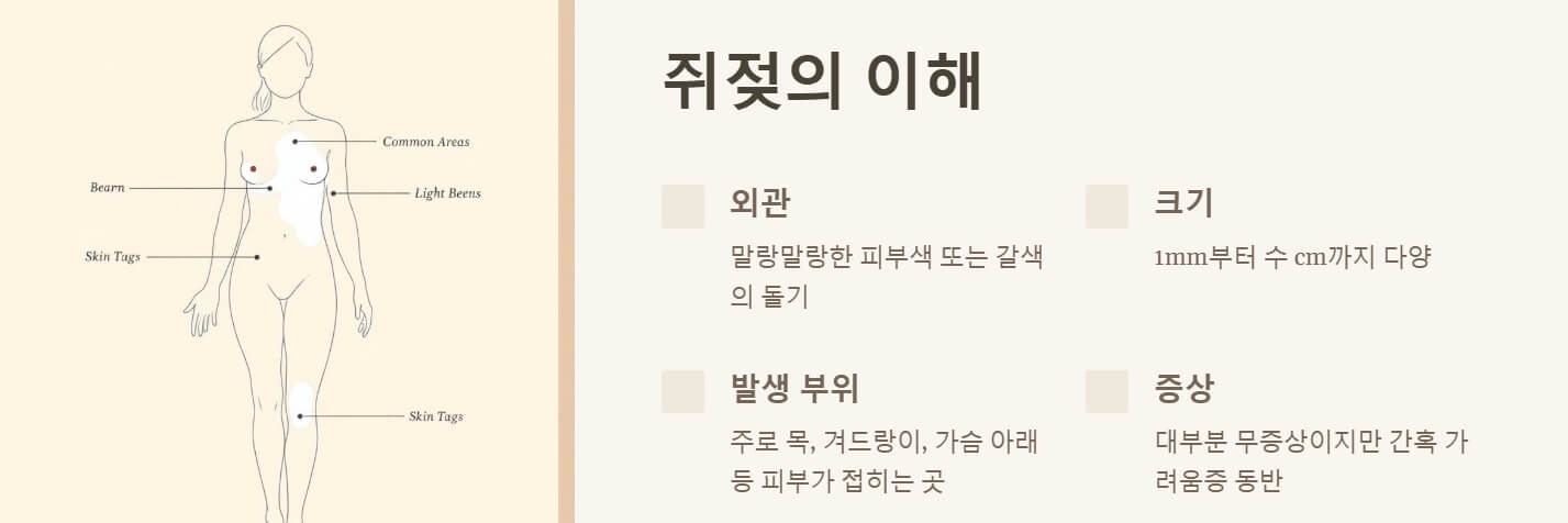 쥐젖 제거방법