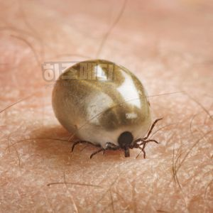 쯔쯔가무시 증상