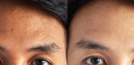 글루타치온 효능, 부작용, 많이든 음식 총정리 (2025ver)