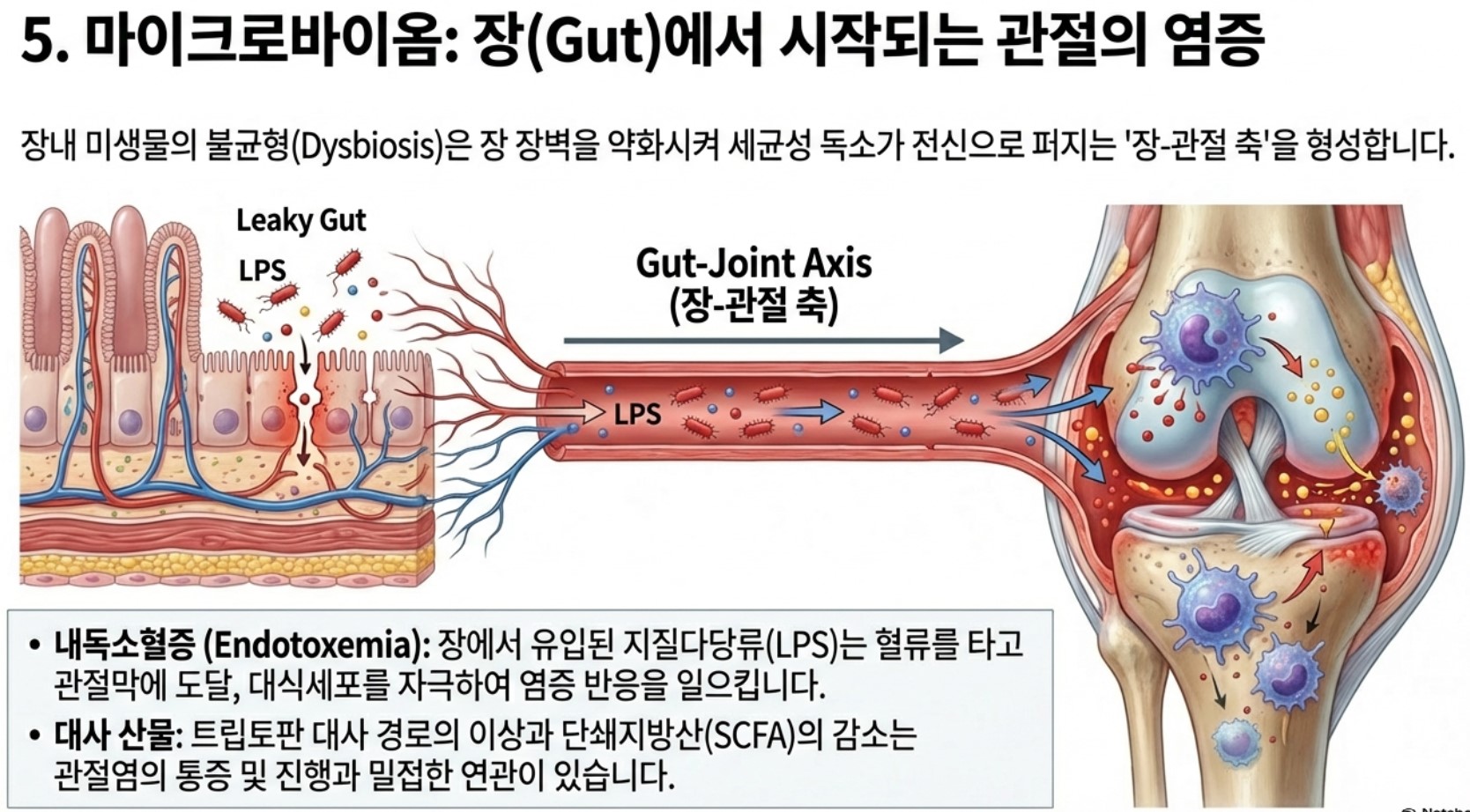 장-관절축