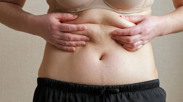 내장지방을 효과적으로 태우는 운동