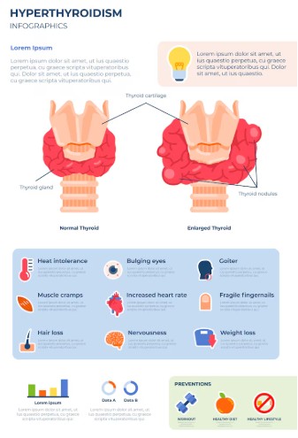 갑상선 기능 항진증에 대해 설명하는 그림