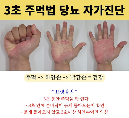 당뇨병 자가진단법(3초 주먹법)