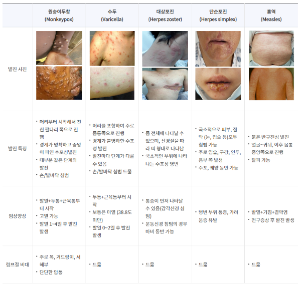 엠폭스