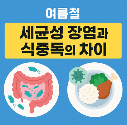 여름철-세균성-장염과-식중독의-차이-이미지