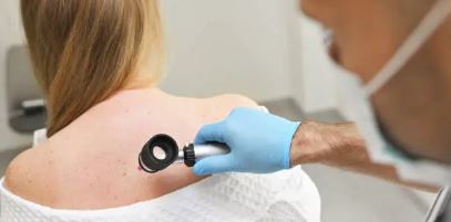 여성 등에 있는 점을 보고 있는 의사 사진