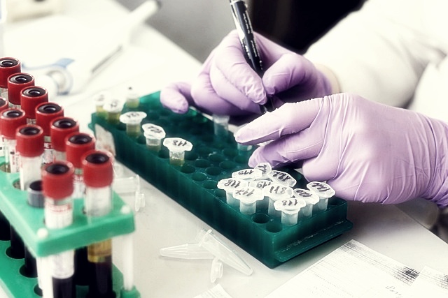 HLB제약 주가분석