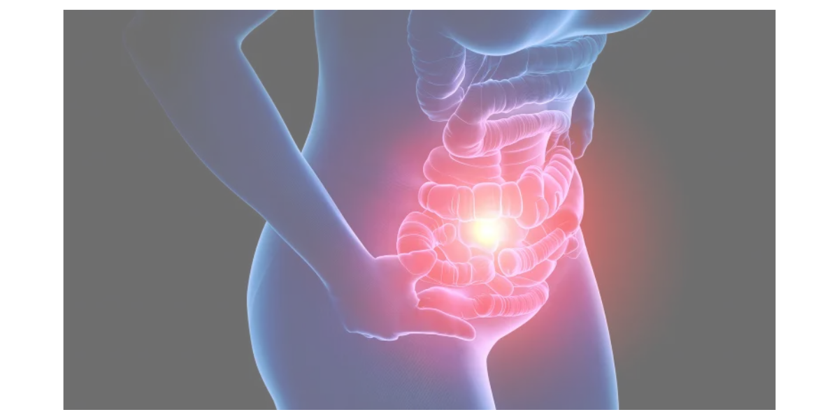 대장암 관련 사진