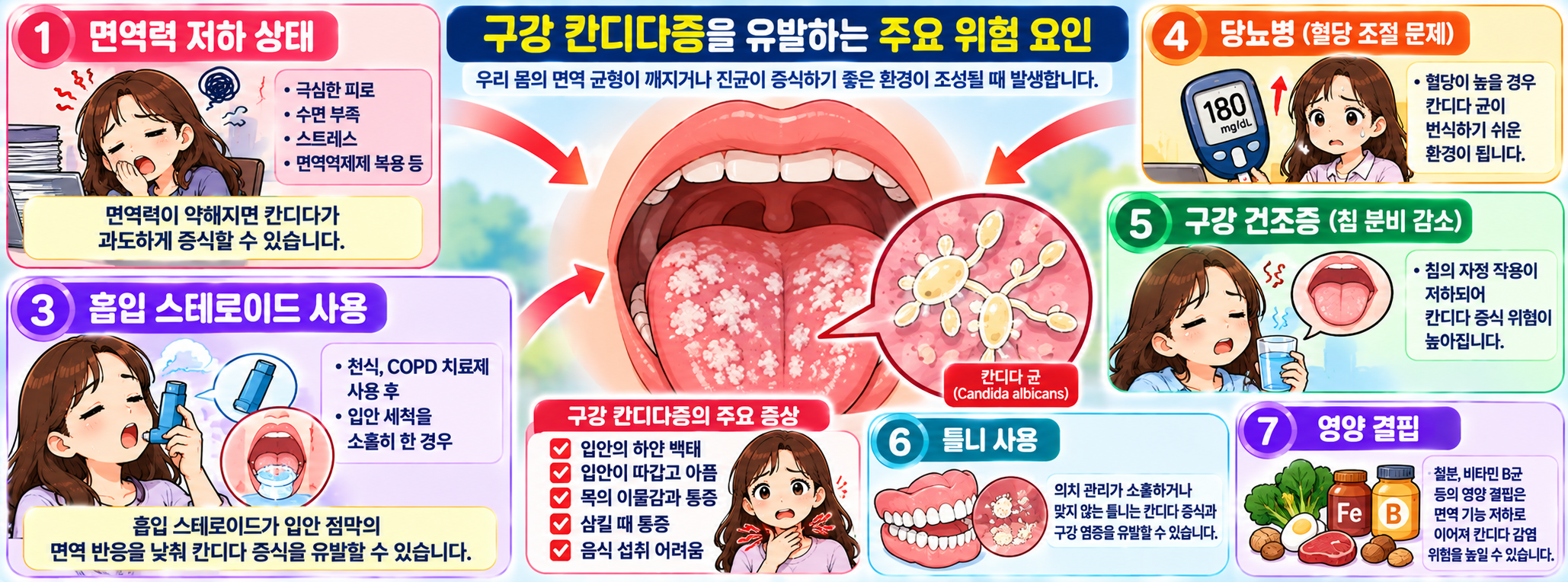 구강 칸디다증을 유발하는 면역력 저하, 항생제, 당뇨 등 주요 위험 요인