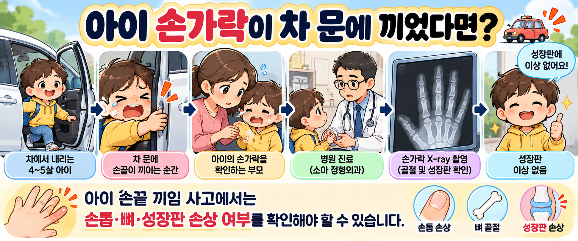 4~5살 아이 손가락이 자동차 문에 끼인 후 병원에서 X-ray와 성장판 검사를 받는 과정을 설명하는 인포그래픽