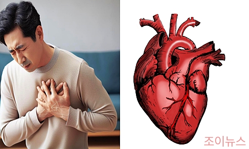 심혈관 질환
