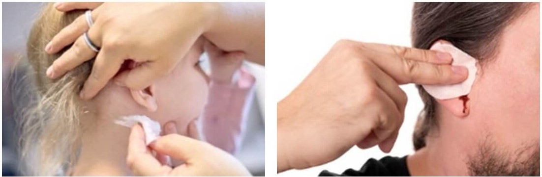 귀 염증