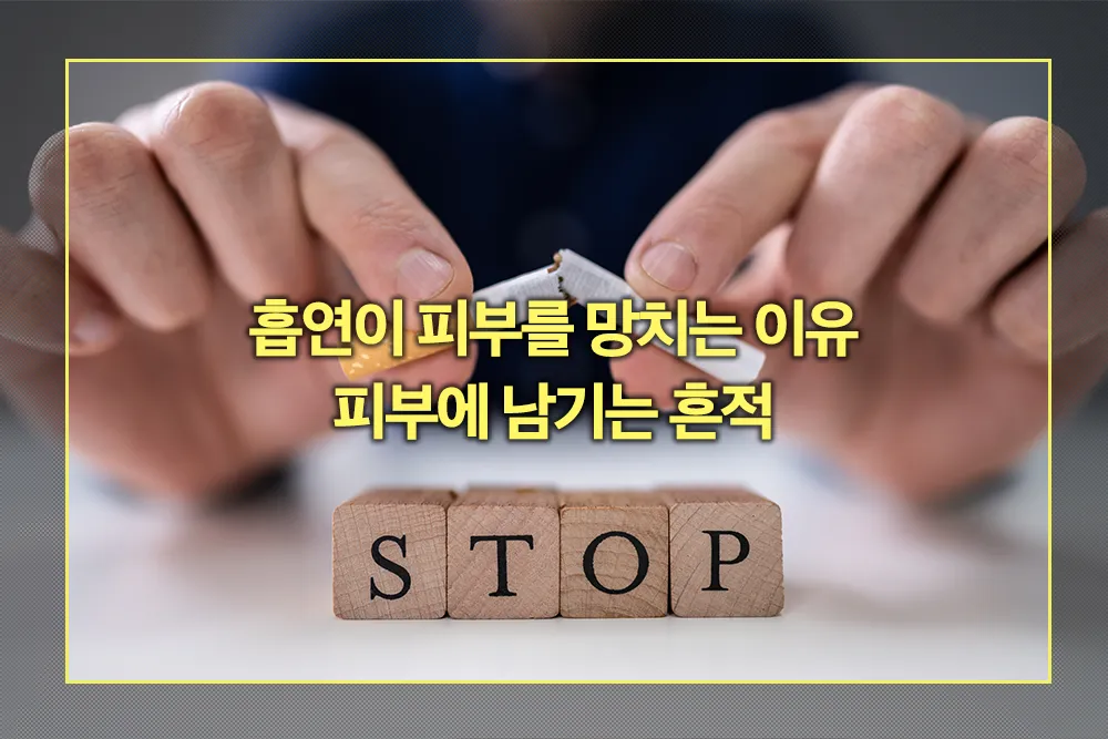 담배 흡연이 피부를 망치는 이유