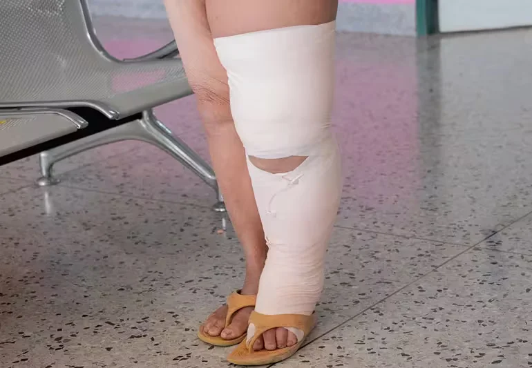 다리 부종, 놓치면 안 되는 7가지 진실