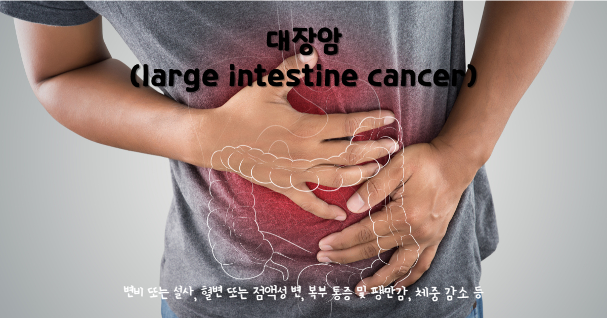대장암(large intestine cancer)
대장암 주요 증상 : 변비 또는 설사, 혈변 또는 점액성 변, 복부 통증 및 팽만감, 체중 감소 등