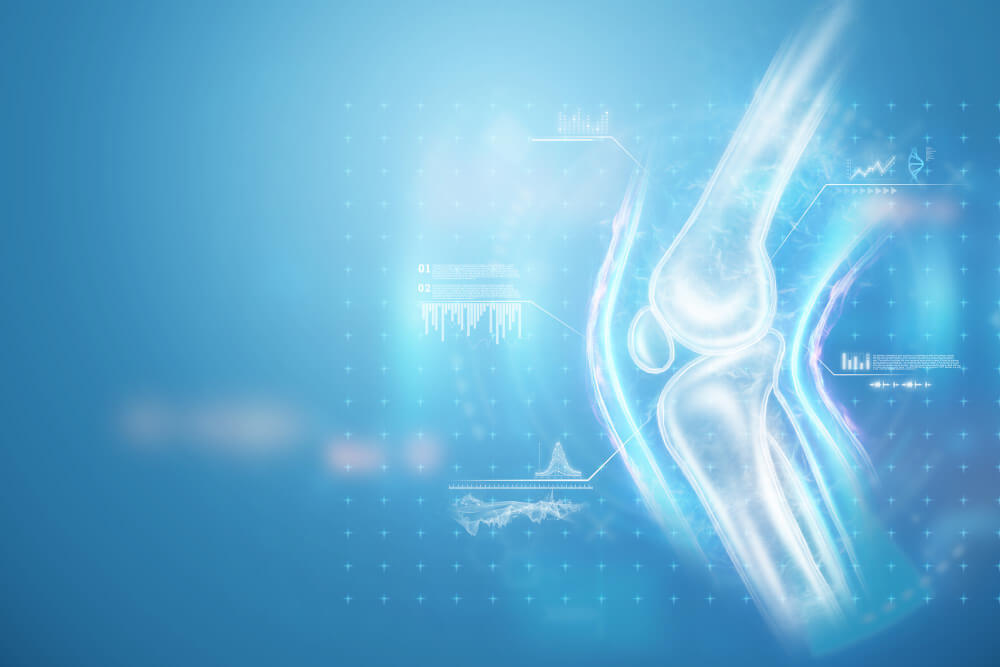 골다공증에 좋은 음식 13가지