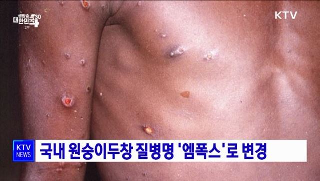 엠폭스 증상