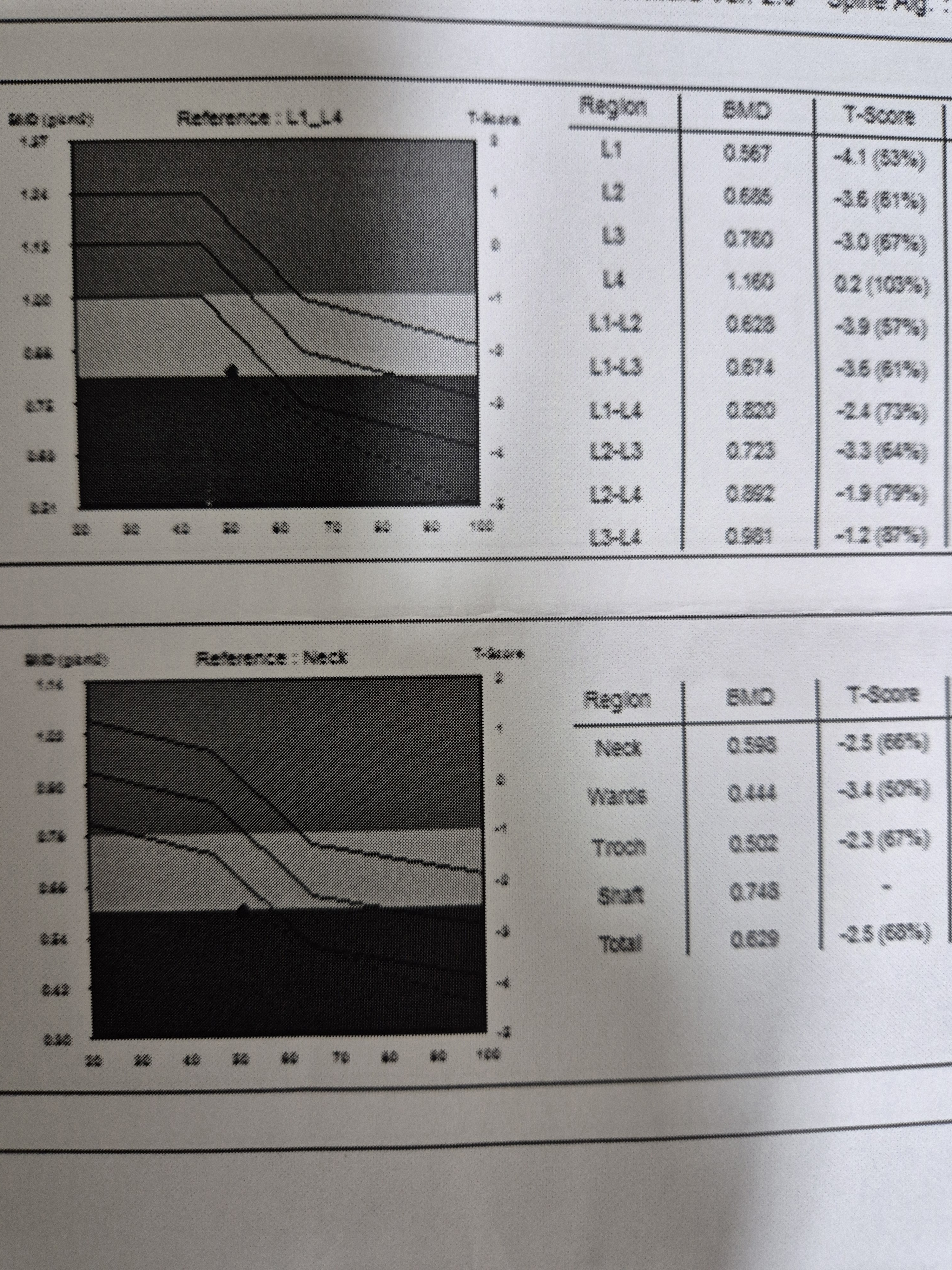 뼈의 골밀도 사진