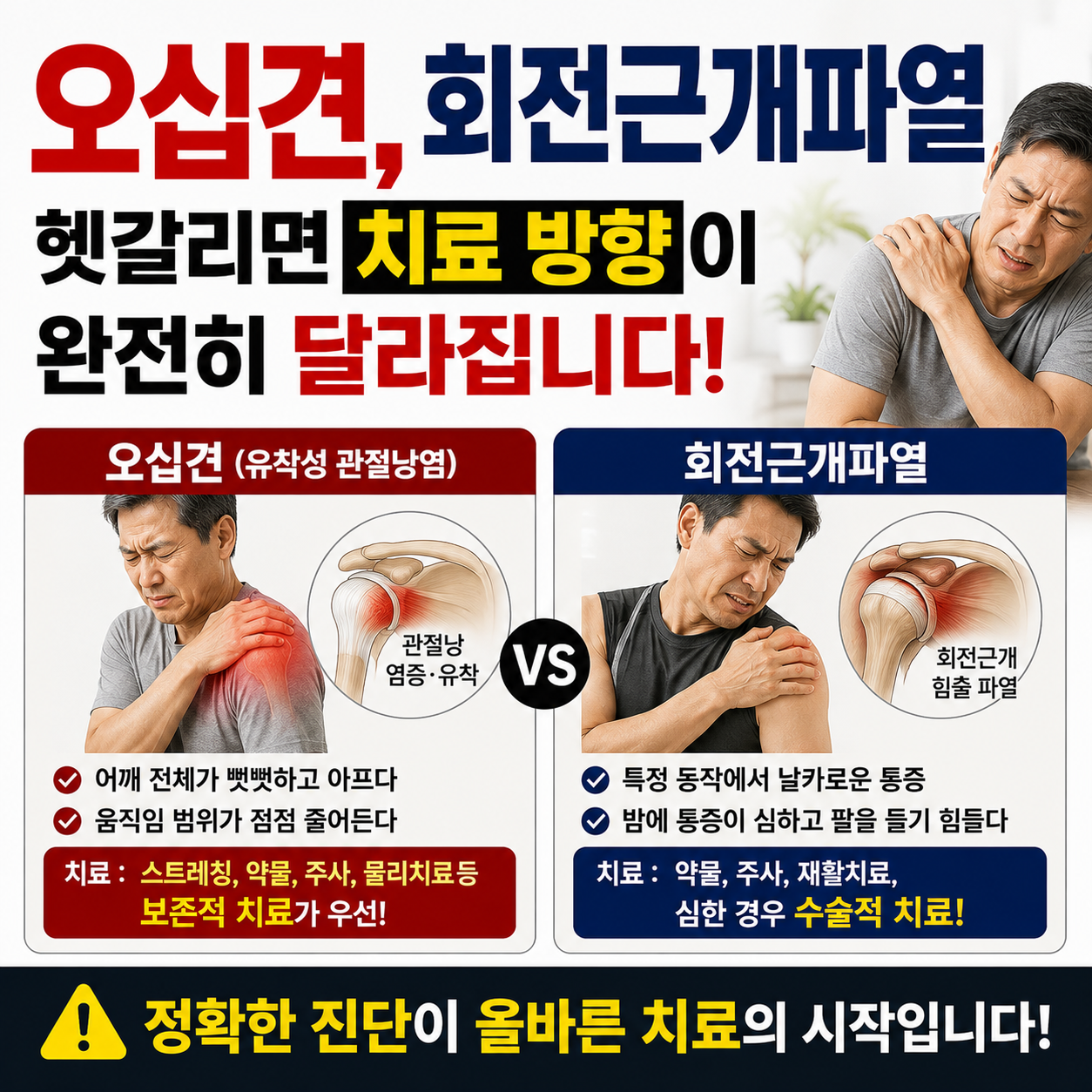 오십견