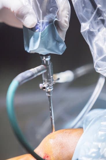 미세 천공술(Microfracture)을 통한 연골 치료