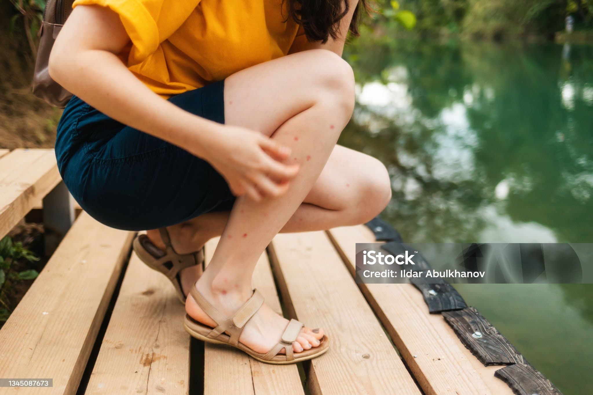 다리가 가려운 이유 무엇일까