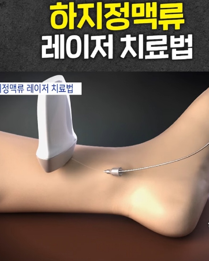 명의-박기혁-교수-하지정맥류