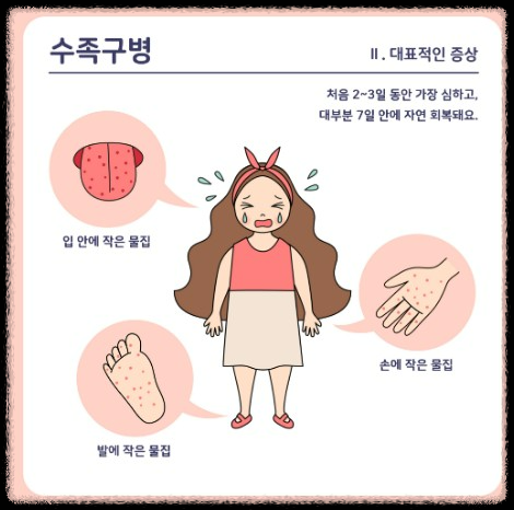 꼭 알아야 할 수족구병: 원인, 예방, 증상, 치료 방법
